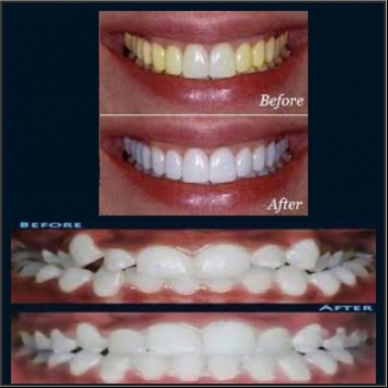 THE%20DENTAL%20HUT