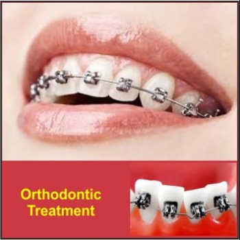 HANAZ%20DENTAL%20CLINIC