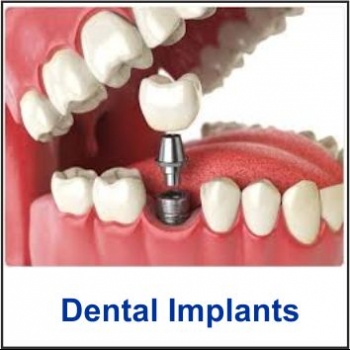HANAZ%20DENTAL%20CLINIC