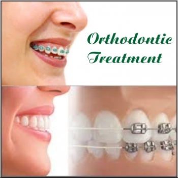 ANGELIN%20DENTAL%20CLINIC