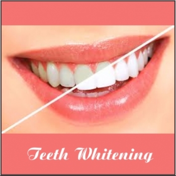 ANGELIN%20DENTAL%20CLINIC