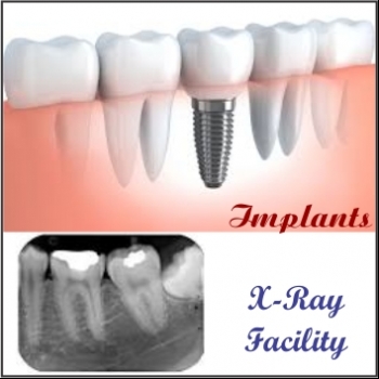 ANGELIN%20DENTAL%20CLINIC